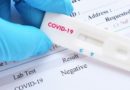 Covid-19 : Explosion des cas avec 520 nouveaux tests positifs, 5 patients en réa et 1 décès